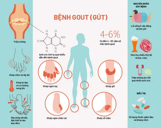 hình ảnh bệnh gout
