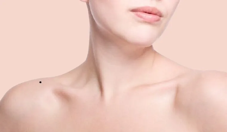 Nốt Ruồi Ở Xương Bả Vai